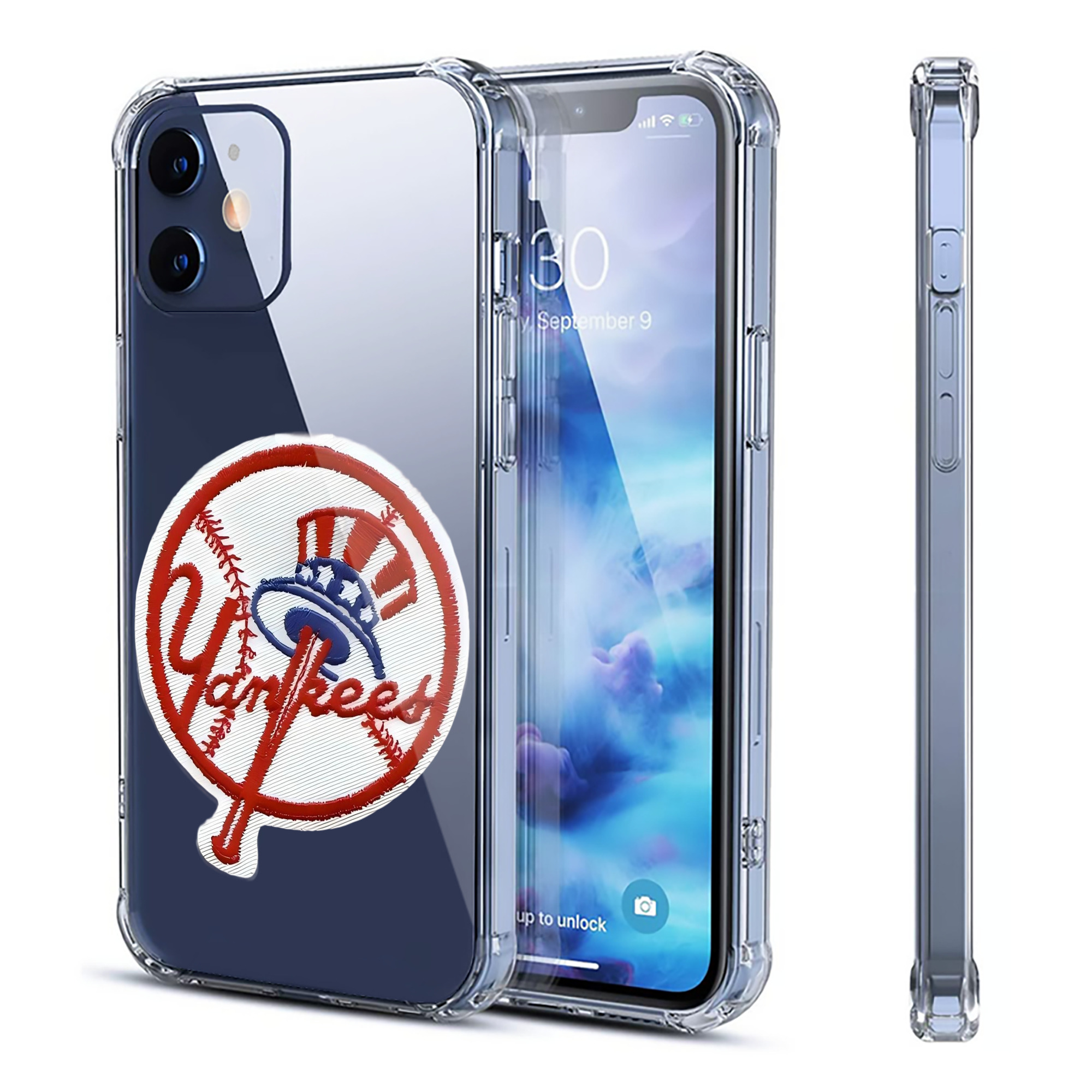 New York Yankees LOGO Clear IPhone 12 Case – Soft TPU With UV Print – Enhanced Drop Protection, Precise Fit, Anti-Fingerprint, Customizable Design, Scratch-Resistant, Yellow-Resistant